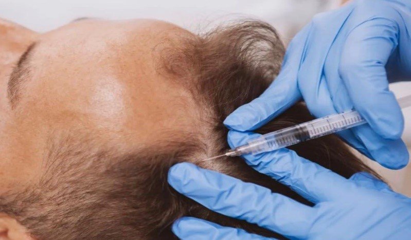 Plasma Rico en Plaquetas